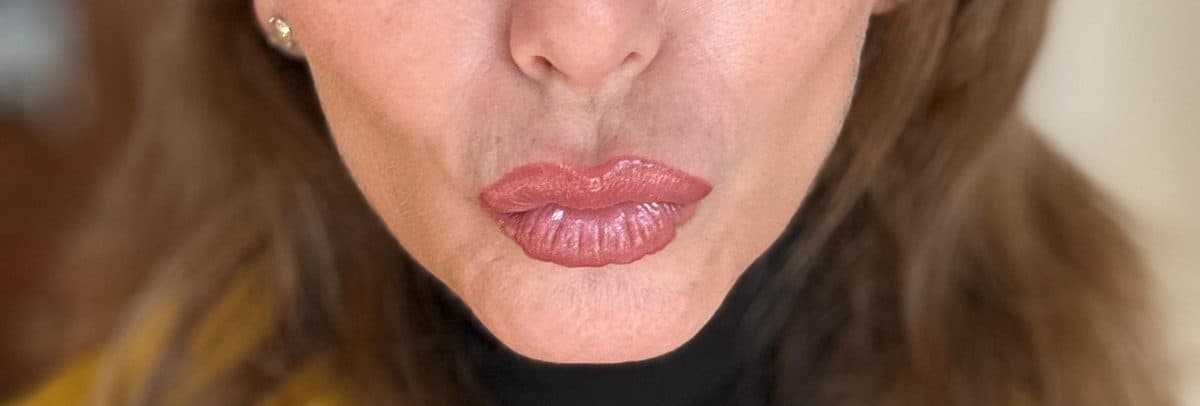 Smooth skin after wrinkle treatment