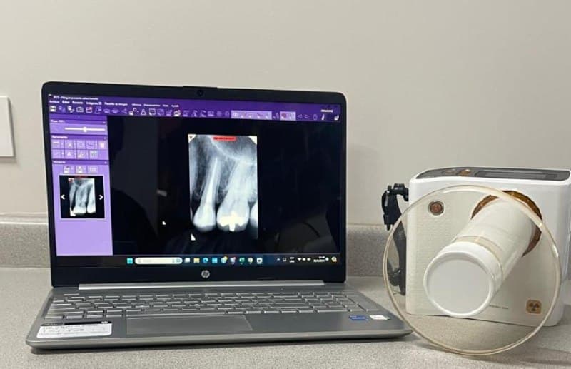 Digital X-Ray Sensors