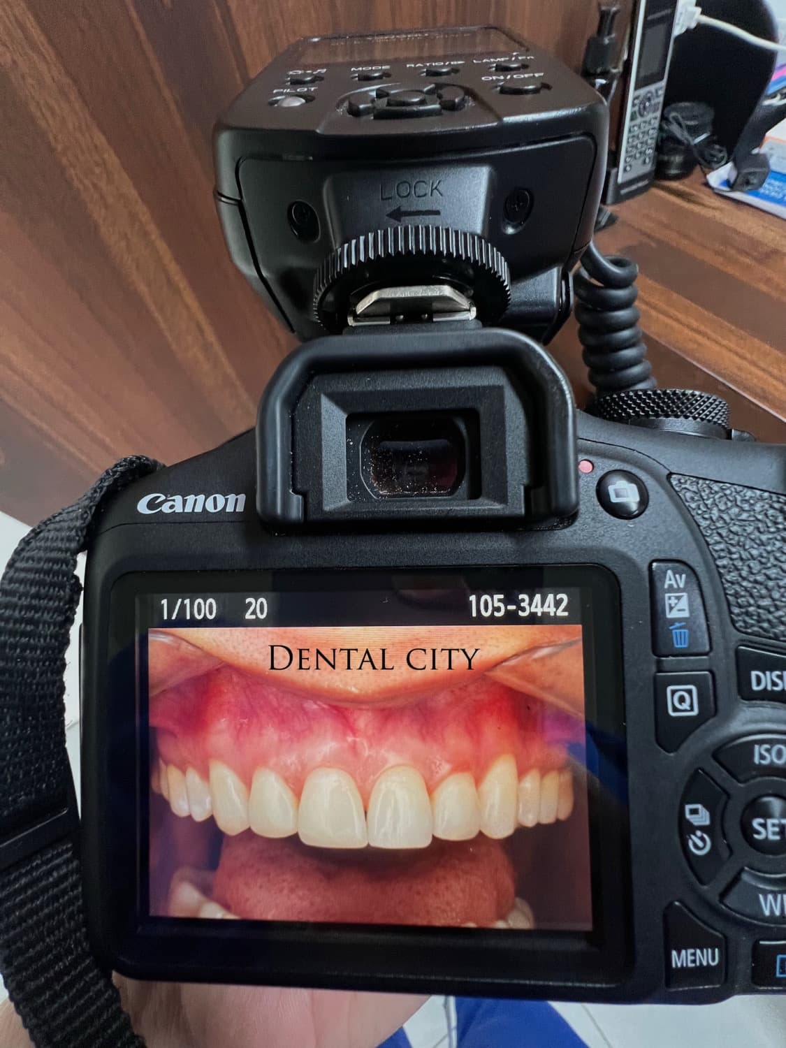 Professional dental photography camera
